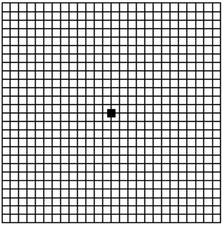 Amsler-Grid-for-checking-for-Macular-Degeneration-by-Dr.-Trent-McKinney
